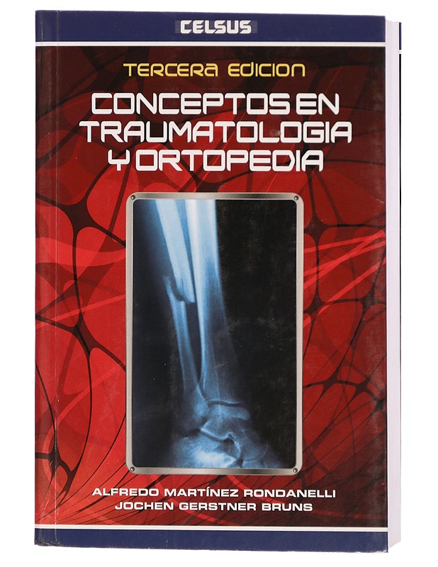 Concepts in traumatology and orthopedics - Martínez Rondanelli. Alfredo - Tietokirjat ja oppaat - 10105301712 - 0