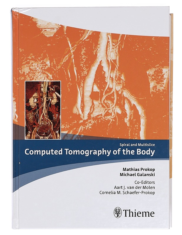 Computed tomography of the body - Tietokirjat ja oppaat - 10105377695 - 0