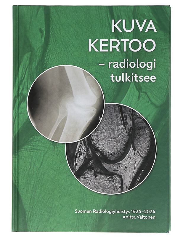 Kuva kertoo - radiologi tulkitsee : Suomen radiologiyhdistys 1924-2024 - Valtonen, Anitta - Historiakirjat - 10105422817 - 0