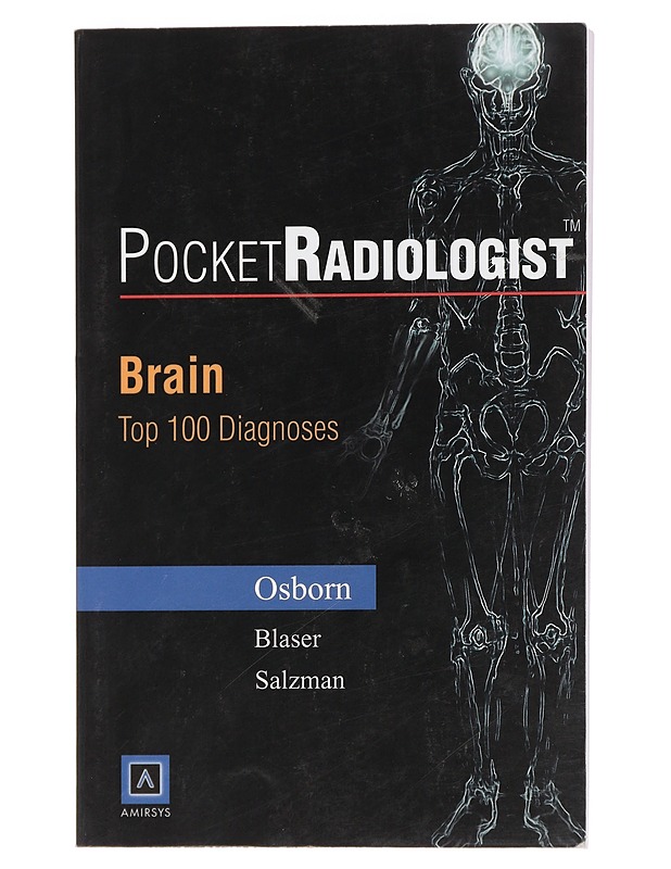 PocketRadiologist : Brain Top 100 Diagnoses - Osborn, Anne G. - Tietokirjat ja oppaat - 10105439457 - 0