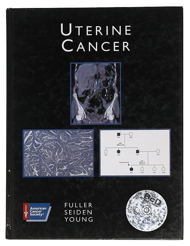 Uterine Cancer - Fuller, Arlan; Young, Robert H. ; Seiden, Michael V. - Tietokirjat ja oppaat - 10105462204 - 0
