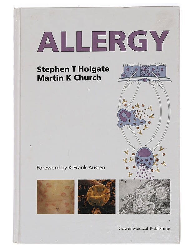 Allergy - Church, Martin K. - Tietokirjat ja oppaat - 10105466387 - 0