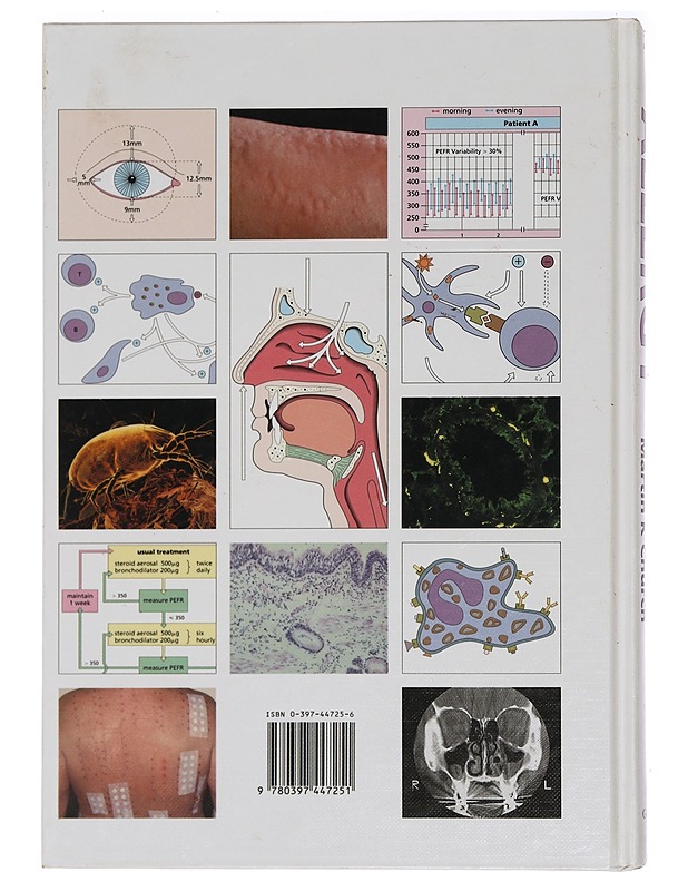 Allergy - Church, Martin K. - Tietokirjat ja oppaat - 10105466387 - 1