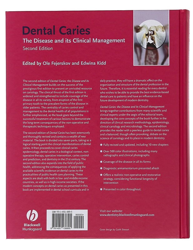 Dental Caries - The Disease and clinical Management  - Ole Fejerskov and Edwina Kidd - Tietokirjat ja oppaat - 10105482372 - 1