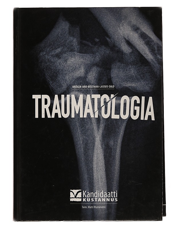 Traumatologia - Aro, Hannu - Tietokirjat ja oppaat - 10105503177 - 0