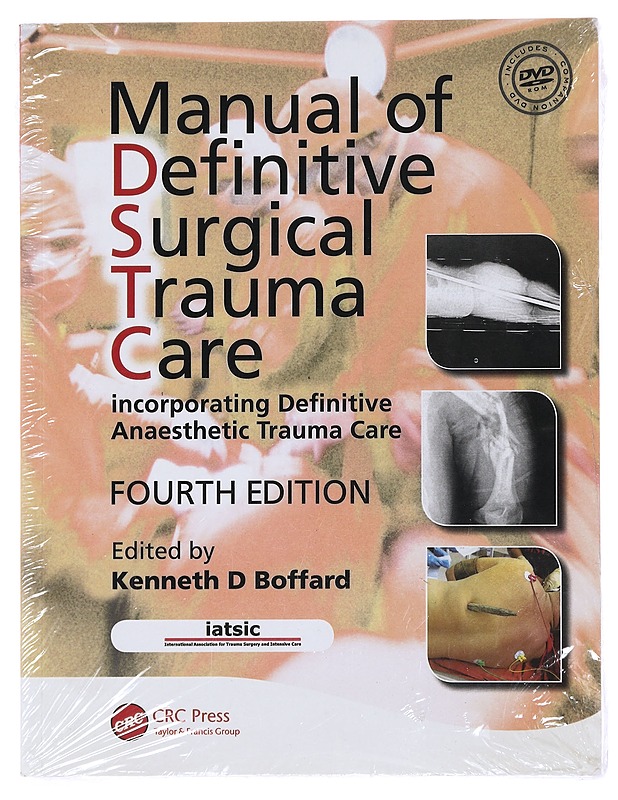 Manual of Definitive Surgical Trauma Care - Boffard, Kenneth D. - Tietokirjat ja oppaat - 10105503494 - 0