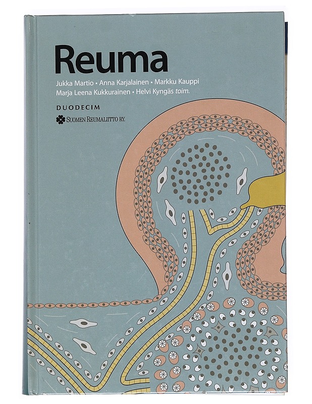 Reuma  - Martio , Jukka ; Karjalainen , Anna ; Kauppi , Markku ; Kukkurainen, Marja Leena ; Kyngäs , Helvi (toim.)  - Tietokirjat ja oppaat - 10105518276 - 0