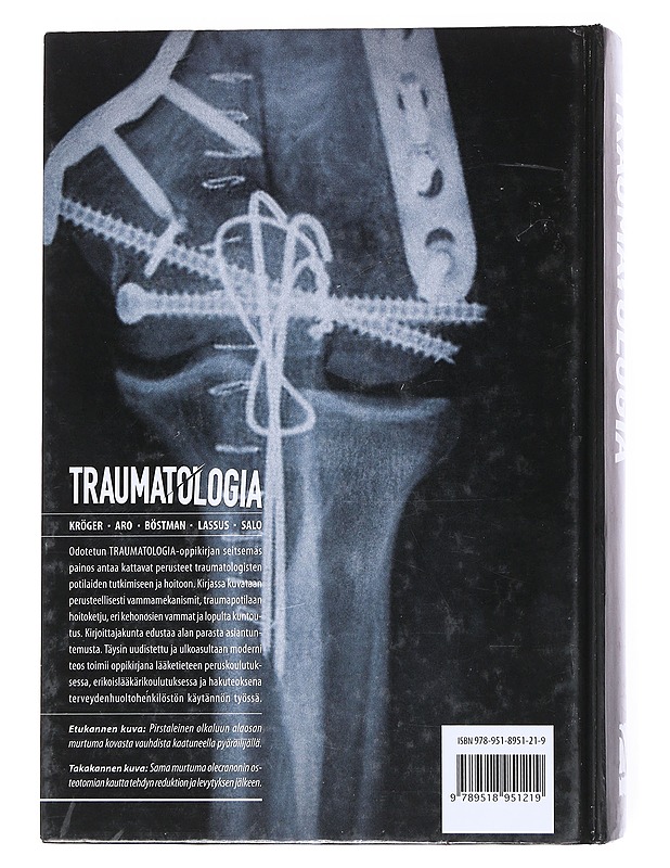 Traumatologia - Aro, Hannu - Tietokirjat ja oppaat - 10105519941 - 1