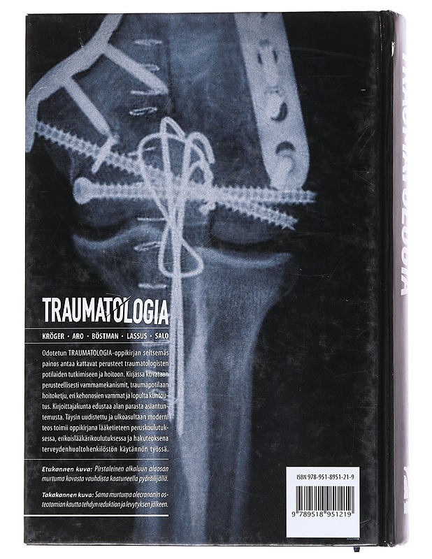 Traumatologia - Aro, Hannu - Tietokirjat ja oppaat - 10105520301 - 1