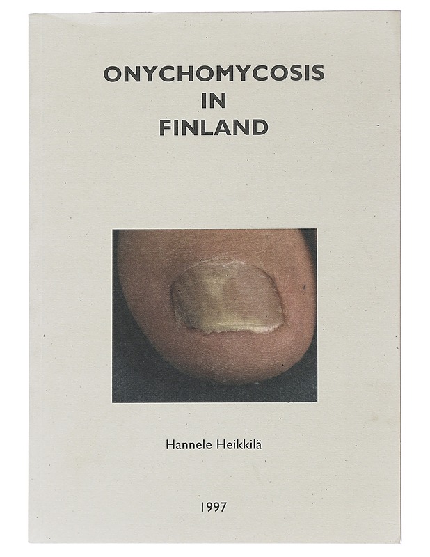 Onychomycosis in Finland - Hannele Heikkilä  - Tietokirjat ja oppaat - 10105520377 - 0