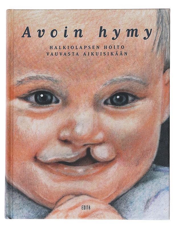 Avoin hymy : halkiolapsen hoito vauvasta aikuisikään - Hukki, Jyri - Historiakirjat - 10105532000 - 0