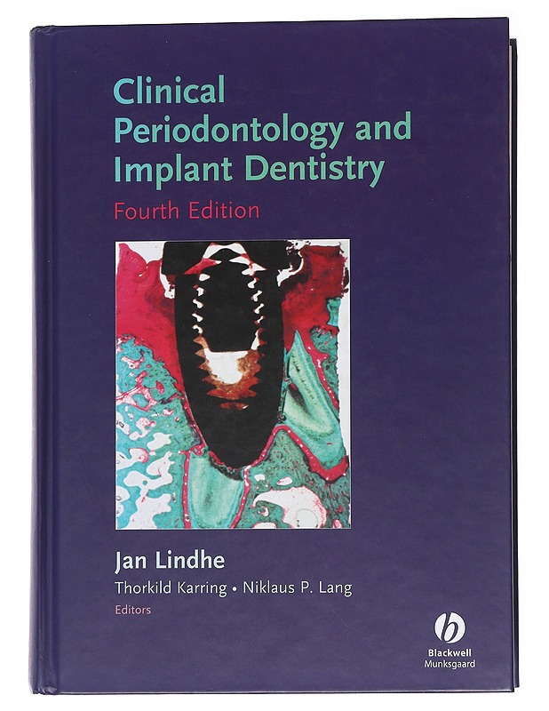 Clinical Periodontology and Implant Dentistry -  Jan Lindhe, Thorkild Karring - Tietokirjat ja oppaat - 10105553928 - 0