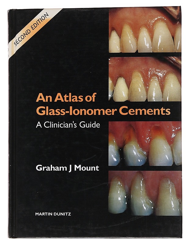An atlas of glass-ionomer cements : a clinician's guide - Graham J. Mount - Tietokirjat ja oppaat - 10105562279 - 0