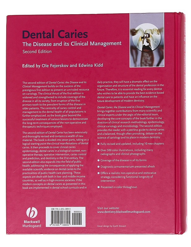 Dental Caries - The Disease and clinical Management - Tietokirjat ja oppaat - 10105562509 - 1