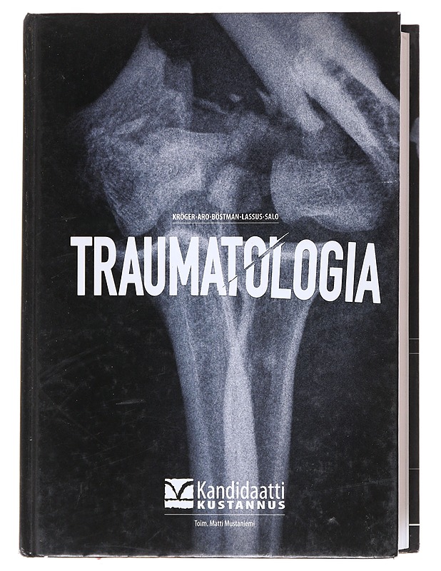 Traumatologia - Aro, Hannu - Tietokirjat ja oppaat - 10105573950 - 0