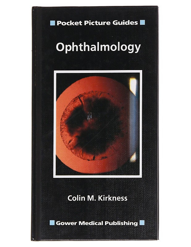Ophthalmology - Kirkness, Colin M. - Tietokirjat ja oppaat - 10105624906 - 0