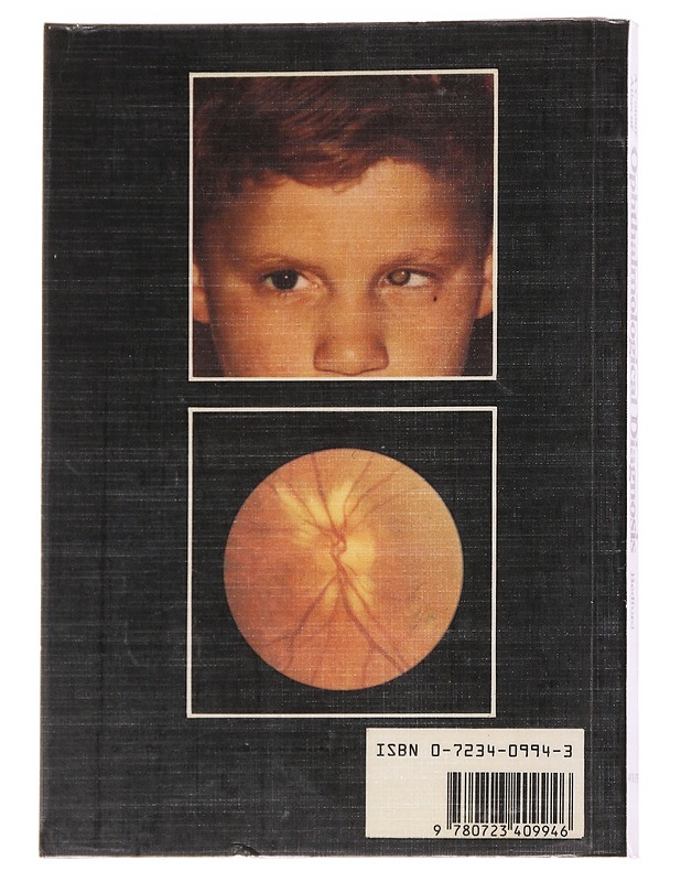 A Colour Atlas of Ophthalmological Diagnosis - M. A. Bedford - Tietokirjat ja oppaat - 10105624920 - 1