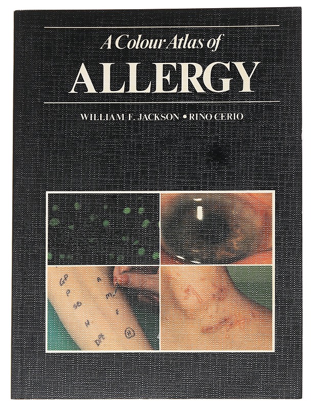 A Colour Atlas of Allergy - Jackson, William F., Cerio Rino - Tietokirjat ja oppaat - 10105625488 - 0