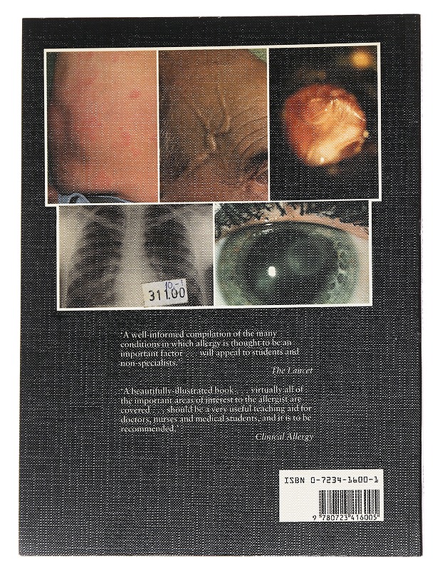 A Colour Atlas of Allergy - Jackson, William F., Cerio Rino - Tietokirjat ja oppaat - 10105625488 - 1