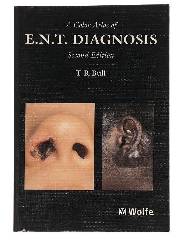 A Color Atlas of E.N.T Diagnosis 2nd Edition - T R Bull - Tietokirjat ja oppaat - 10105626637 - 0