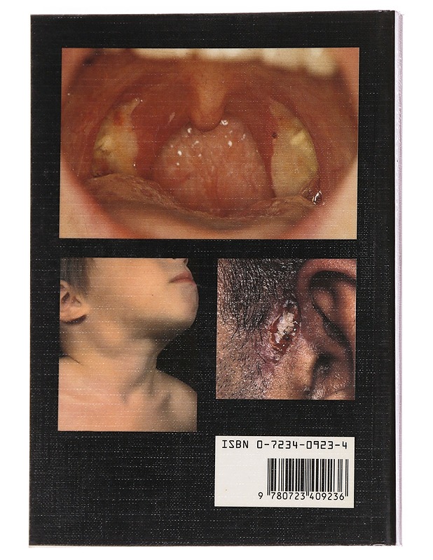 A Color Atlas of E.N.T Diagnosis 2nd Edition - T R Bull - Tietokirjat ja oppaat - 10105626637 - 1