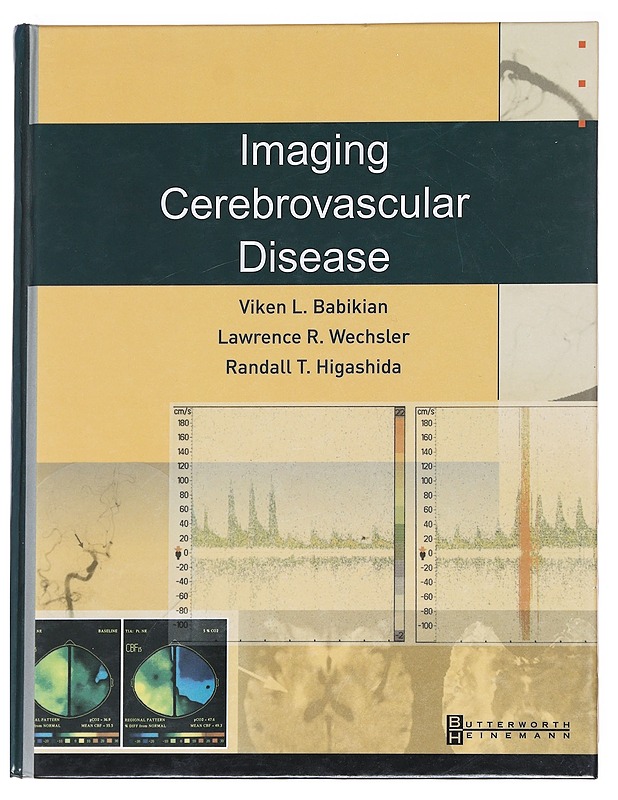 Imaging Cerebrovascular Disease - Babikian, Viken L. - Tietokirjat ja oppaat - 10105627003 - 0