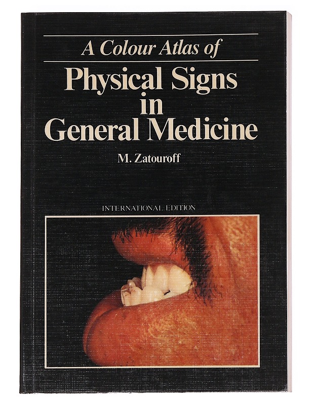 A Colour Atlas of Physical Signs in General Medicine - M. Zatouroff - Tietokirjat ja oppaat - 10105627565 - 0
