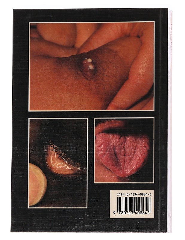 A Colour Atlas of Physical Signs in General Medicine - M. Zatouroff - Tietokirjat ja oppaat - 10105627565 - 1