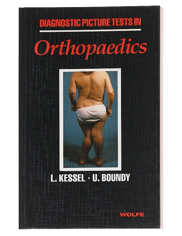 Diagnostic PictureTests in Orthopaedics - L. Kessel - Tietokirjat ja oppaat - 10105627571 - 0